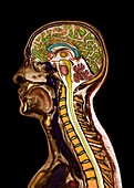 Head and neck, sagittal MRI