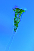 Vorticella protozoan, light micrograph