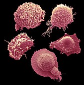 Cells from the most common female cancers, SEM