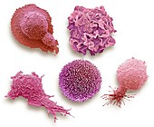 Cells from cancers with highest mortality rates, SEM