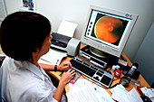 Diabetic retinopathy screening