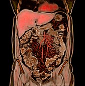 Abdominal organs, MRI scan