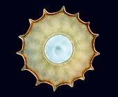 Arcella sp. shelled amoeba, light micrograph