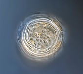 Campanella protozoan, light micrograph
