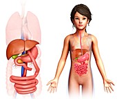 Child with gastric bypass, illustration