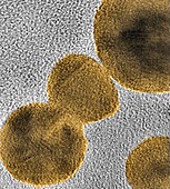 Gold nanoparticles, TEM