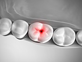 Human tooth pain, illustration