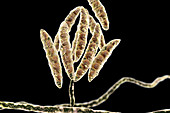 Fusarium fungus conidia, illustration