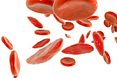 Sickle cell red blood cells, illustration