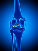 Knee meniscus, illustration