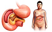 Pancreas and duodenum, illustration