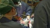 Tumour removal surgery