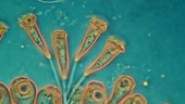 Epistylis ciliates, light microscopy