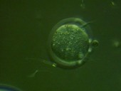 Sperm fertilising ovum, light microscopy