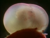 Rat embryo in capsule, light microscopy