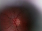Human eye examination