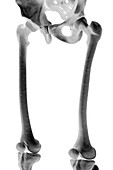 Bones of the Upper Legs, artwork