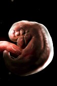 Embryo Development (Week 6), artwork