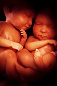Twin Babies, artwork