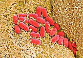 EHEC bacteria on human colon tissue, SEM