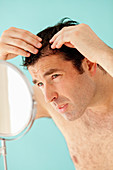 Male hair loss