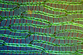 Sphagnum moss, light micrograph