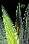 Desmids on sphagnum moss, light micrograph