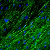 Dermal fibroblast cells, fluorescence light micrograph