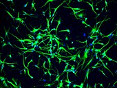 Neural stem cells, fluorescence light micrograph