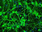 Brain hippocampus neurons, fluorescence light micrograph