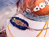 Intravenous fluid warmer in operating room