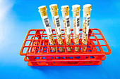 Lentils in test tubes in a test tube rack