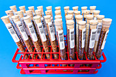 Food samples in test tubes in a test tube rack