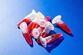 Eppendorf tubes containing blood samples