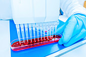 Microbiologist using micropipettes