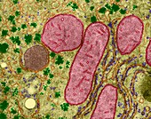 Cellular organelles from a liver cell, TEM