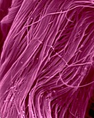 Heart muscle collagen fibres, SEM