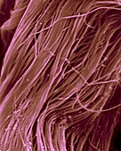 Heart muscle collagen fibres, SEM