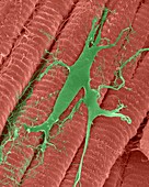 Heart muscle with purine fibres, SEM