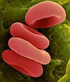 Red blood cells in the Rouleau formation, SEM