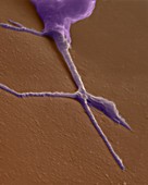 Growth cone from a developing neuron, SEM