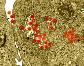 Herpes simplex virus, TEM