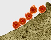 Herpes simplex virus, TEM