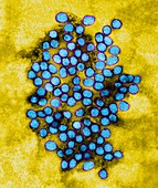 Yellow Fever Virus, TEM