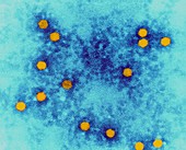 Polio virus, TEM