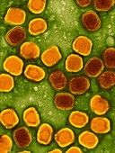 Variola virus, the cause of smallpox, TEM
