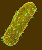 Bacteriophages attacking Escherichia coli, SEM