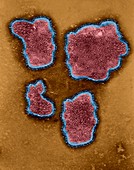 Respiratory syncytial virus, TEM