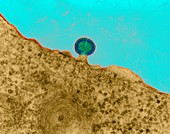 HIV infection in lymph tissue, TEM
