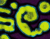 Influenza A virus, TEM